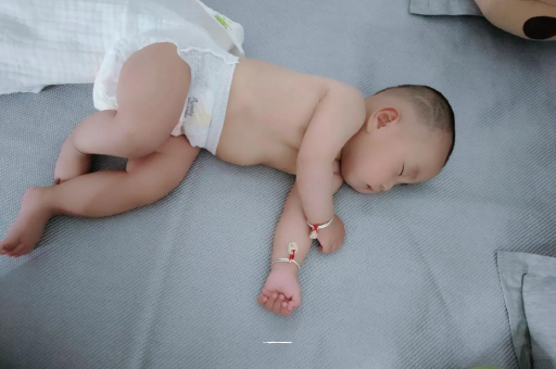 黄骅六个月宝宝眼睛散光